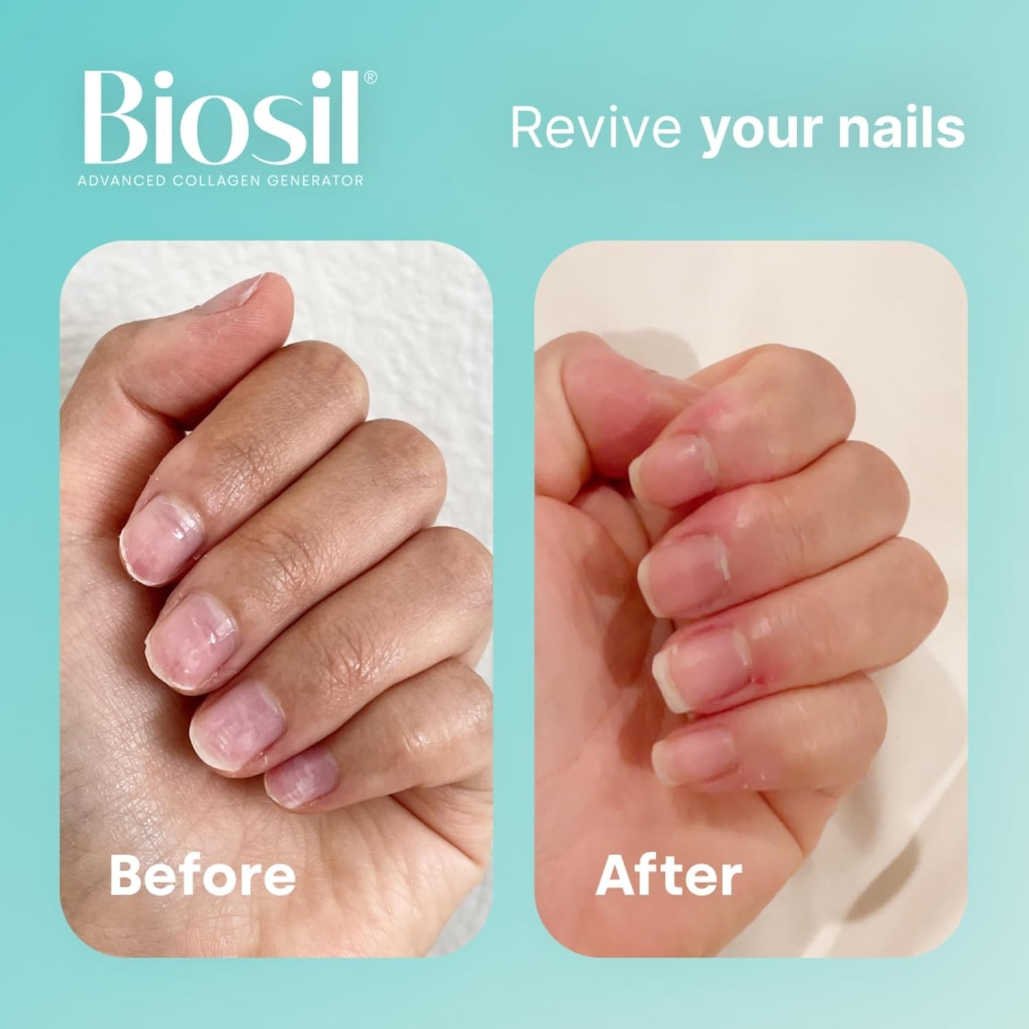 120 Capsules -Biosil Collagen Generator with ch-OSA | Hair , Skin & Nail Health