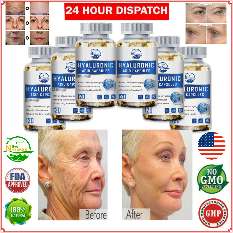 Hyaluronic Acid Turmeric 850mg 720 Capsules Latest Date