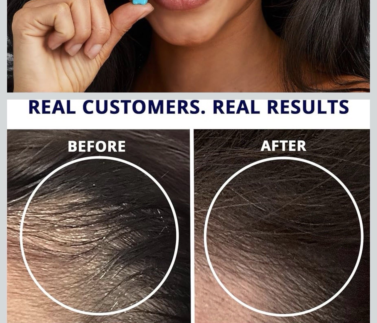 SugarBearPro Hair Vitamin Gummy 1 Month Supply, Extra Strength Biotin